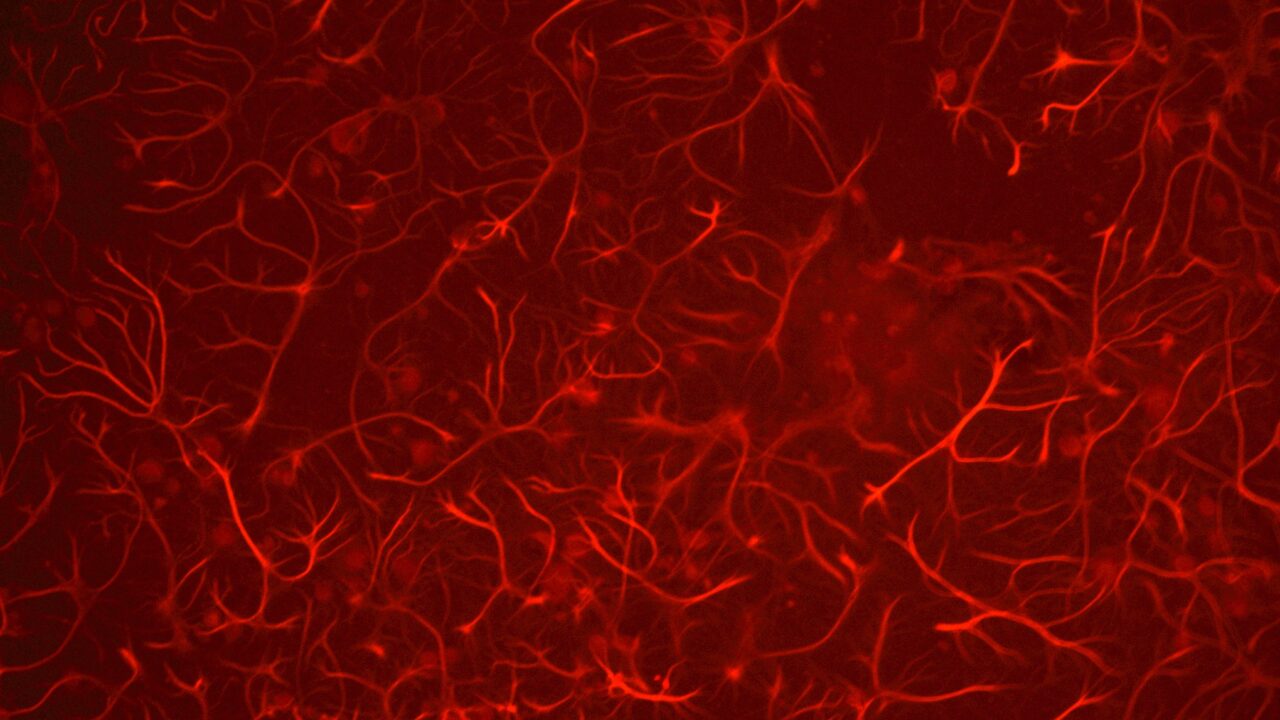 Mikroskoobi pilt roti ajukoore gliiarakkudest (astrotsüüdid) | Pilt: TalTechi molekulaarse neurobioloogia labor