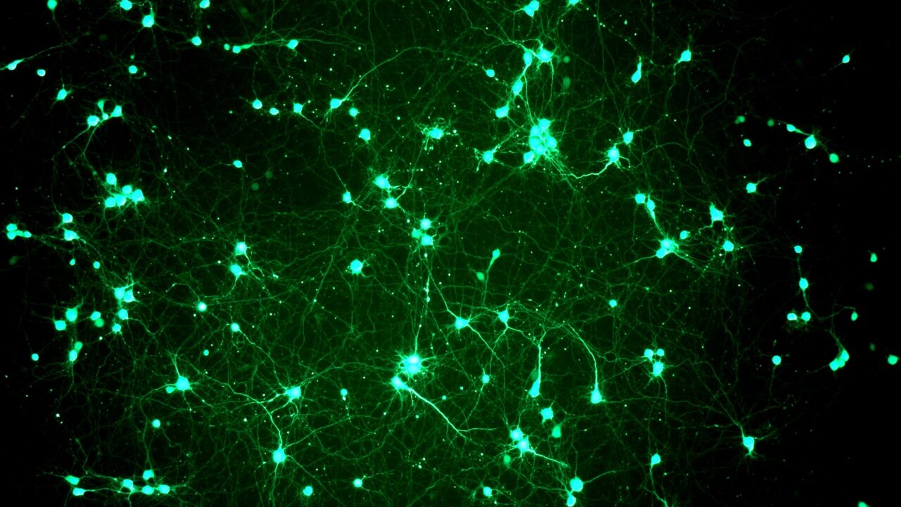 Mikroskoobi pilt roti ajukoore närvirakkudest | Pilt: TalTechi molekulaarse neurobioloogia labor