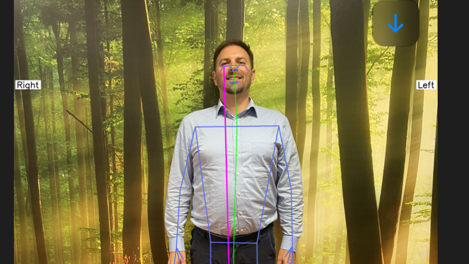 Jeffrey Andrew Tuhtan rääkis, et rühirakendus kasutab arvutinägemist ja tehisaru, et tuvastada automaatselt keha probleemsed kohad ja mõõta võimalikke asümmeetriaid. Tuhtani sõnul soovis meeskond luua vabalt kättesaadava tööriista, mis ei vaja spetsialisti abi. Foto: Jeffrey Andrew Tuhtan